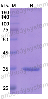 Recombinant Human SDCBP Protein, N-His