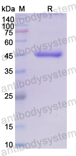 Recombinant Human PODXL Protein, N-His