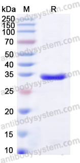 Recombinant Human FCN1 Protein, N-His