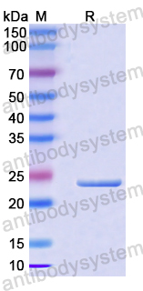 Recombinant Human FCN1 Protein, N-His