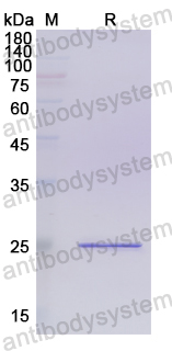 Recombinant Human CCN1 Protein, N-His