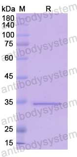 Recombinant Human WNT10B Protein, N-His