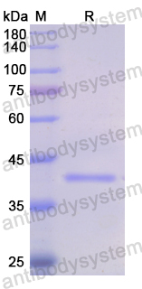 Recombinant Human CES2 Protein, N-GST