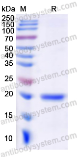 Recombinant Human UBE2C Protein, N-His