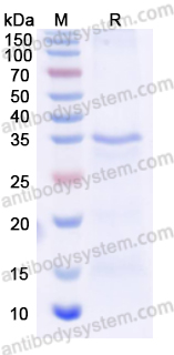 Recombinant Human SCD Protein, N-His