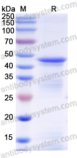 Recombinant Human ISLR Protein, N-His