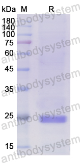 Recombinant Human SOCS2 Protein, N-His