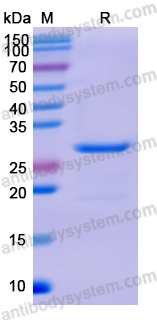 Recombinant Human SOCS3 Protein, N-His