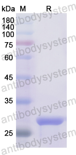 Recombinant Human CCS Protein, N-His