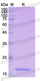 Recombinant Human DVL1 Protein, N-His