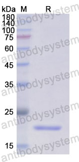 Recombinant Human DVL2 Protein, N-His