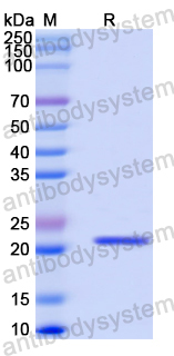 Recombinant Human DVL2 Protein, N-His-SUMO