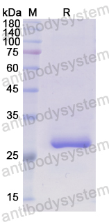 Recombinant Human TOR1B Protein, N-His