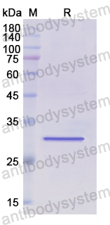 Recombinant Human ABCD4 Protein, N-His