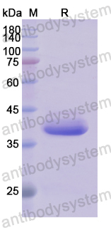 Recombinant Human APAF1 Protein, N-His