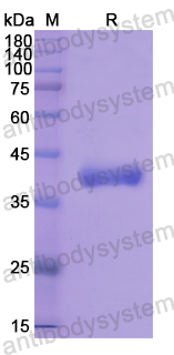 Recombinant Human MAP2K7 Protein, N-His