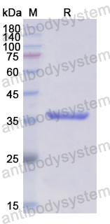 Recombinant Human TPP1 Protein, N-His