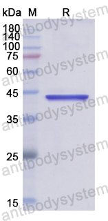 Recombinant Human NDC80/HEC1 Protein, N-His