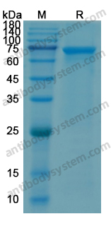 Recombinant Human CD304/NRP1 Protein, N-His