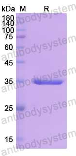 Recombinant Human CD304/NRP1 Protein, N-His