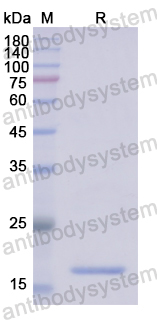 Recombinant Human CPLX1 Protein, N-His