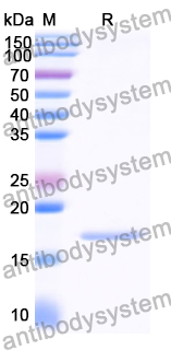 Recombinant Human CPLX1 Protein, N-His