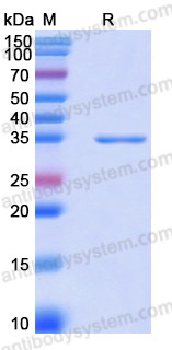 Recombinant Human PHYH Protein, N-His