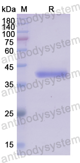 Recombinant Human AIM2 Protein, N-His