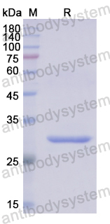 Recombinant Human IRF6 Protein, N-His