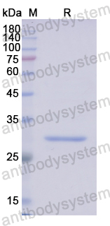 Recombinant Human FSCN2 Protein, N-His