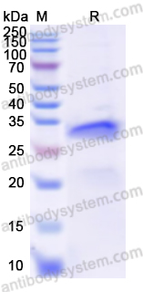 Recombinant Human EREG Protein, N-GST & C-His