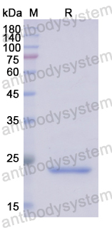 Recombinant Human MYL12B Protein, N-His