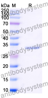 Recombinant Human UQCR11 Protein, N-GST