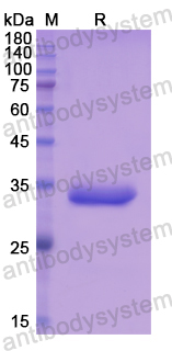 Recombinant Human AZIN1 Protein, N-His