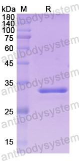 Recombinant Human DCLK1 Protein, N-His