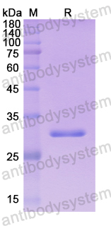 Recombinant Human NPC1 Protein, N-His