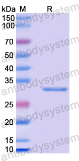 Recombinant Human NPC1 Protein, N-His