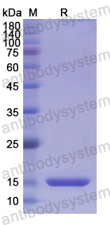 Recombinant Human TBX3 Protein, N-His