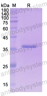 Recombinant Human ARPC2 Protein, N-His