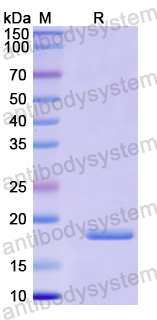 Recombinant Human ARPC3 Protein, N-His