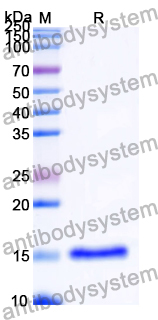 Recombinant Human MDM4 Protein, N-His