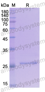 Recombinant Human AXIN1 Protein, N-His