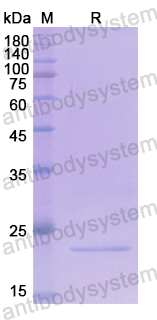 Recombinant Human CETN3 Protein, N-His