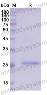 Recombinant Human CTDSPL Protein, N-His