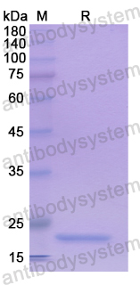 Recombinant Human UBD Protein, N-His