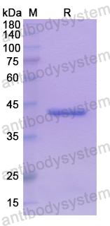 Recombinant Human KMO Protein, N-His