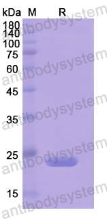 Recombinant Human LAMA5 Protein, N-His