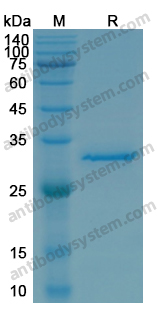 Recombinant Human MAPK13 Protein, N-His