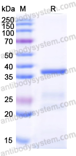 Recombinant Human OGT Protein, N-His