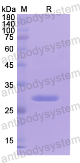 Recombinant Human ALOX15B Protein, N-His